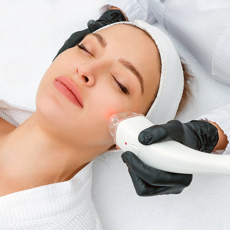 A woman relaxing in a robe receiving laser hair removal treatment on her face.